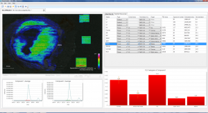 MALDI imaging of an eyeball